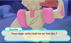Un Ouvrifier blessé physiquement.